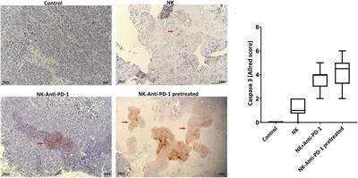 Adaptive NK Cell Therapy Modulated by Anti-PD-1 Antibody in Gastric Cancer Model